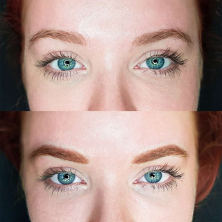 Freckle - Línea Híbrida